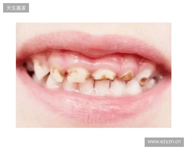 韦林顿确诊上唇部贯通伤；11、21牙半脱位；上颌前牙区牙槽骨骨折