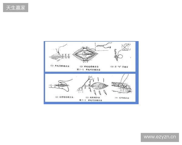 广州豹官方:杨浩眉弓伤口缝合30余针,预计5-7天后拆线 广州豹官方:杨浩眉弓伤口缝合30余针,预计5-7天后拆线